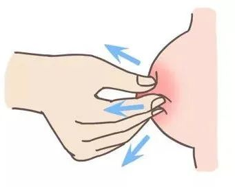 大乳頭、小乳頭、扁平乳頭、凹陷乳頭3大喂養(yǎng)指導(dǎo)及護(hù)理指南！