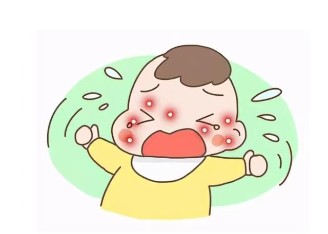 孩子濕疹反復(fù)發(fā)作怎么辦？這些防治方法請(qǐng)收好！